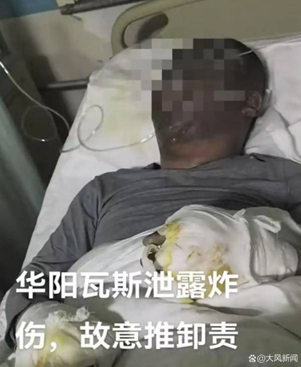 山西一地因管道氣體泄漏爆炸造成4人受傷<strong></p>
<p>管道泄漏濾</strong>，官方發(fā)布情況說明:管道泄漏濾