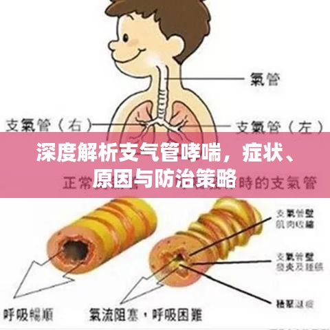 深度解析支氣管哮喘，癥狀、原因與防治策略