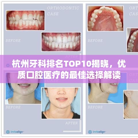 杭州牙科排名TOP10揭曉，優(yōu)質(zhì)口腔醫(yī)療的最佳選擇解讀