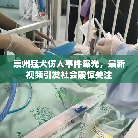 崇州猛犬傷人事件曝光，最新視頻引發(fā)社會(huì)震驚關(guān)注