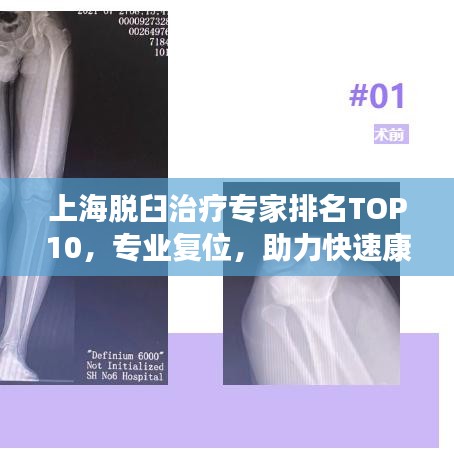 上海脫臼治療專(zhuān)家排名TOP10，專(zhuān)業(yè)復(fù)位，助力快速康復(fù)